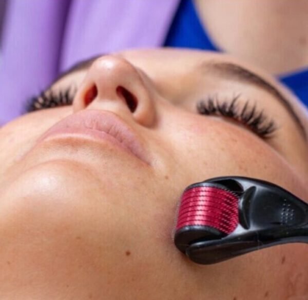 Adatinis volelis Derma Roller mezoterapijai 0,5 mm